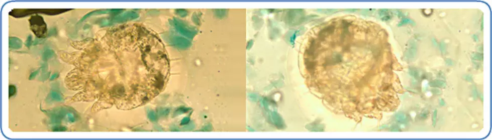 Microscopic scabies. (CDC)